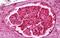 Galectin 1 antibody, NBP2-11500, Novus Biologicals, Immunohistochemistry paraffin image 