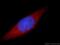 Histone methyltransferase SMYD2 antibody, 21290-1-AP, Proteintech Group, Immunofluorescence image 