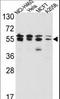 Inosine Monophosphate Dehydrogenase 2 antibody, LS-C100583, Lifespan Biosciences, Western Blot image 