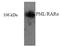Probable transcription factor PML antibody, AP32355PU-N, Origene, Western Blot image 