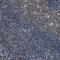 Inositol Polyphosphate-5-Phosphatase A antibody, NBP1-89361, Novus Biologicals, Immunohistochemistry paraffin image 