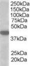 Solute Carrier Family 16 Member 7 antibody, PA5-17960, Invitrogen Antibodies, Western Blot image 