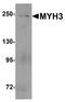 Myosin Heavy Chain 3 antibody, A02697, Boster Biological Technology, Western Blot image 