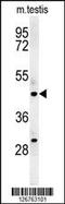 STAM Binding Protein Like 1 antibody, 61-882, ProSci, Western Blot image 