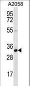 Calponin 2 antibody, LS-C168882, Lifespan Biosciences, Western Blot image 