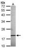 Anterior Gradient 3, Protein Disulphide Isomerase Family Member antibody, PA5-34749, Invitrogen Antibodies, Western Blot image 