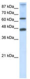 Zinc Finger Protein 79 antibody, TA339148, Origene, Western Blot image 