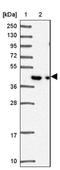 Leukocyte Receptor Cluster Member 9 antibody, NBP2-30893, Novus Biologicals, Western Blot image 