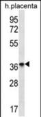 Olfactory Receptor Family 8 Subfamily D Member 4 antibody, PA5-48395, Invitrogen Antibodies, Western Blot image 