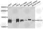 Activating Signal Cointegrator 1 Complex Subunit 3 antibody, A7960, ABclonal Technology, Western Blot image 
