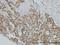 Progesterone Receptor antibody, H00005241-M01, Novus Biologicals, Immunohistochemistry paraffin image 