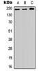 HEAT Repeat Containing 1 antibody, GTX56047, GeneTex, Western Blot image 