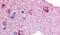 Glycogen Phosphorylase B antibody, PA5-32782, Invitrogen Antibodies, Immunohistochemistry paraffin image 