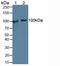 Cartilage Oligomeric Matrix Protein antibody, LS-C685562, Lifespan Biosciences, Western Blot image 