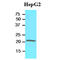 Retinol Binding Protein 4 antibody, GTX57569, GeneTex, Western Blot image 