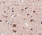 Coiled-Coil Domain Containing 134 antibody, A14619, Boster Biological Technology, Immunohistochemistry frozen image 