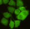 Cyclin Dependent Kinase 1 antibody, STJ99114, St John