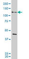 EPH Receptor B3 antibody, LS-C133178, Lifespan Biosciences, Western Blot image 