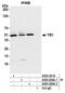 Y-Box Binding Protein 1 antibody, A303-230A, Bethyl Labs, Immunoprecipitation image 