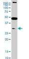 SET Domain Containing 7, Histone Lysine Methyltransferase antibody, H00080854-M01, Novus Biologicals, Western Blot image 