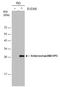 Enterovirus antibody, GTX633706, GeneTex, Western Blot image 