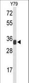 Ribosomal Protein L5 antibody, LS-C162717, Lifespan Biosciences, Western Blot image 