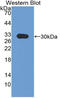 Integrin Subunit Alpha 1 antibody, LS-C314753, Lifespan Biosciences, Western Blot image 