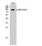 Protein Kinase D2 antibody, A04056S876-1, Boster Biological Technology, Western Blot image 