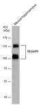 DLG Associated Protein 1 antibody, GTX133264, GeneTex, Western Blot image 