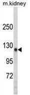 Teashirt Zinc Finger Homeobox 1 antibody, AP18189PU-N, Origene, Western Blot image 