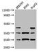 Phosphatidylcholine Transfer Protein antibody, A63118-100, Epigentek, Western Blot image 