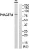 Phosphatase And Actin Regulator 4 antibody, TA315767, Origene, Western Blot image 