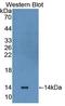 Laminin Subunit Beta 3 antibody, LS-C374318, Lifespan Biosciences, Western Blot image 