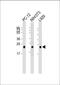 Transforming protein RhoA antibody, M00207-3, Boster Biological Technology, Western Blot image 