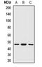 SMYD Family Member 5 antibody, LS-C668174, Lifespan Biosciences, Western Blot image 