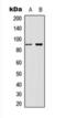 Catenin Beta 1 antibody, orb393261, Biorbyt, Western Blot image 
