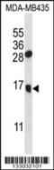 Granulysin antibody, 56-835, ProSci, Western Blot image 