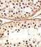 Defensin Beta 107B antibody, A18902, Boster Biological Technology, Immunohistochemistry paraffin image 