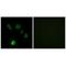 Fibroblast Growth Factor 18 antibody, A04181, Boster Biological Technology, Immunohistochemistry paraffin image 