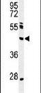 Nei Like DNA Glycosylase 1 antibody, PA5-26700, Invitrogen Antibodies, Western Blot image 
