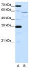 NOVA Alternative Splicing Regulator 2 antibody, TA345801, Origene, Western Blot image 