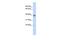 Rab Geranylgeranyltransferase Subunit Beta antibody, GTX46212, GeneTex, Western Blot image 