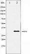 Integrin Subunit Beta 3 antibody, orb106327, Biorbyt, Western Blot image 
