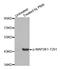 Mitogen-Activated Protein Kinase Kinase 1 antibody, STJ22235, St John