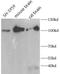 Reticulon 1 antibody, FNab10714, FineTest, Western Blot image 