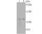 Rho/Rac Guanine Nucleotide Exchange Factor 2 antibody, A02572-2, Boster Biological Technology, Western Blot image 