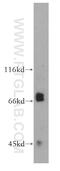 Oligophrenin-4 antibody, 21609-1-AP, Proteintech Group, Western Blot image 