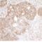 EMAP Like 4 antibody, NBP1-05973, Novus Biologicals, Immunohistochemistry paraffin image 