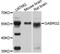 Gamma-Aminobutyric Acid Type A Receptor Gamma2 Subunit antibody, MBS127825, MyBioSource, Western Blot image 