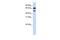 SURP and G-patch domain-containing protein 1 antibody, GTX47197, GeneTex, Western Blot image 